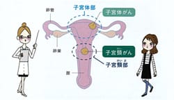 子宮がん検診